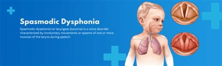 Can you cure spasmodic dysphonia?