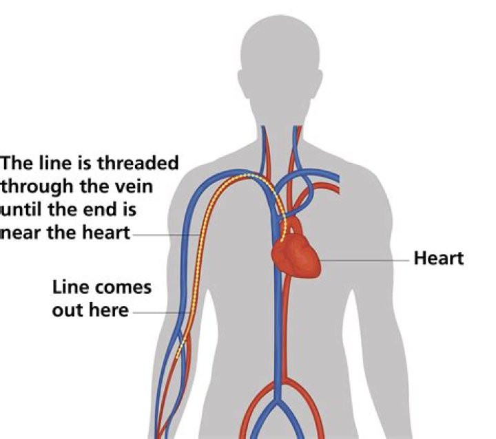 Does a PICC line go into your heart?