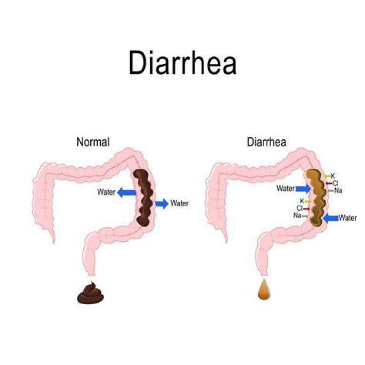 Does glimepiride cause diarrhea?