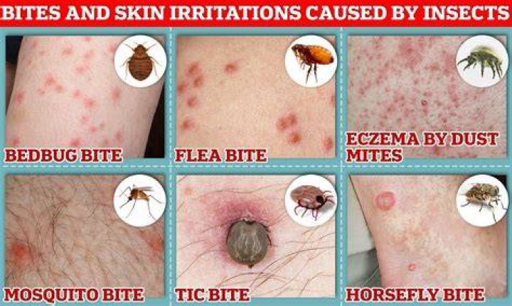 What do bed mites bites look like?