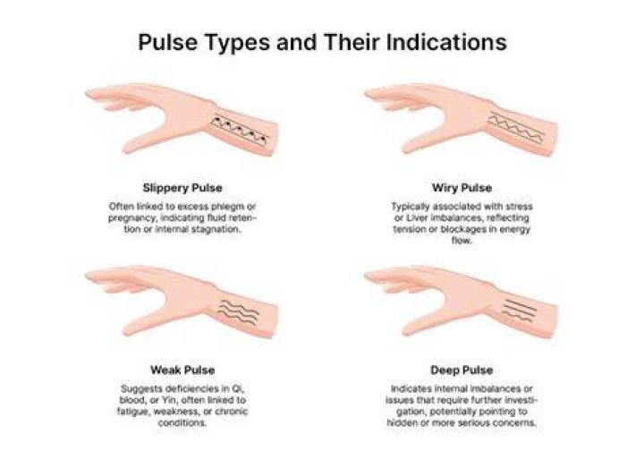 What is a wiry pulse?