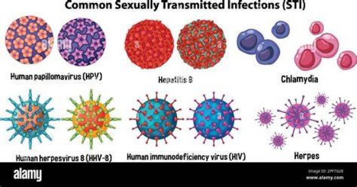 What is STI stock?