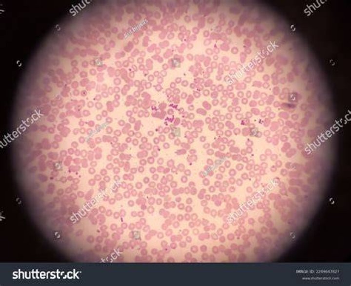 What is the clumping of blood called?