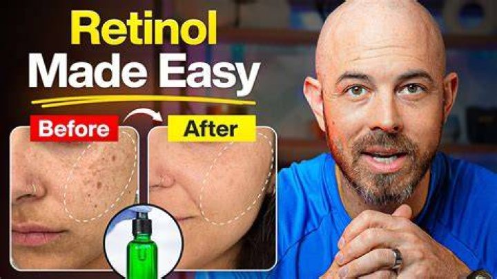 Where do you get retinol from?
