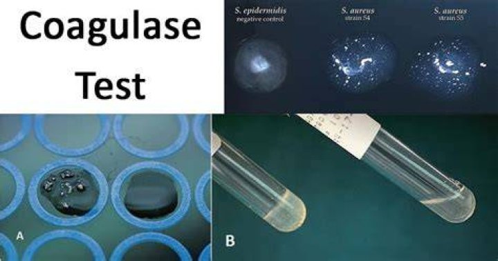 Which bacteria is the coagulase test useful for identification?
